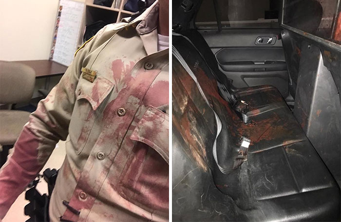 He's A Police Officer That Was One Of The First There. This Was The Back Seat Of His Police Care After Having To Put A Woman Inside With Gunshot Wound To The Head He's A Police Officer That Was One Of The First There. This Was The Back Seat Of His Police Care After Having To Put A Woman Inside With Gunshot Wound To The Head