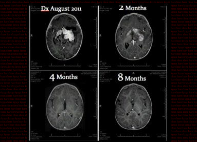 Unknown facts about cancer cells forecasting Unknown facts about cancer cells recommendations
