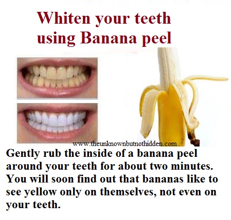 Doctors Recommended Natural and Best Teeth Whitening Technique.