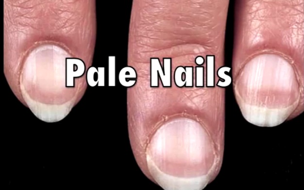 How your Nails give you Warning Signs and Alerts about your Health