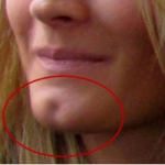 chin