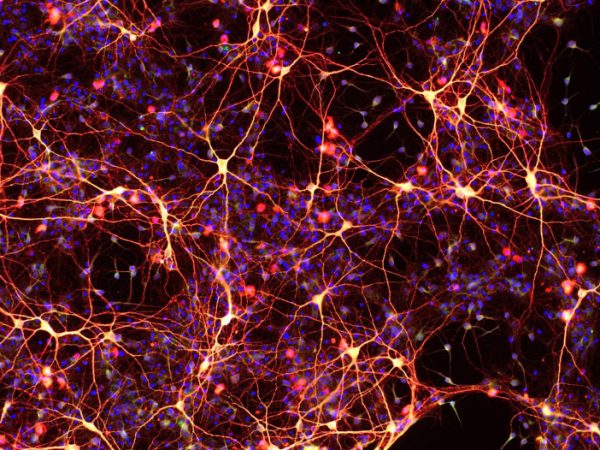 heart-neurons